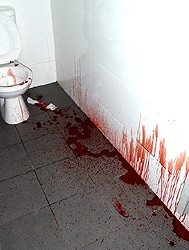 Photo of a bathroom with blood splattered along the wall