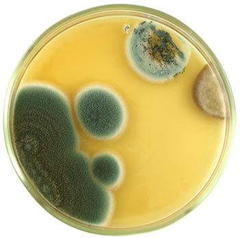 Photo of aspergillus mold growing in a petrie dish
